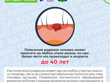 3 родинки